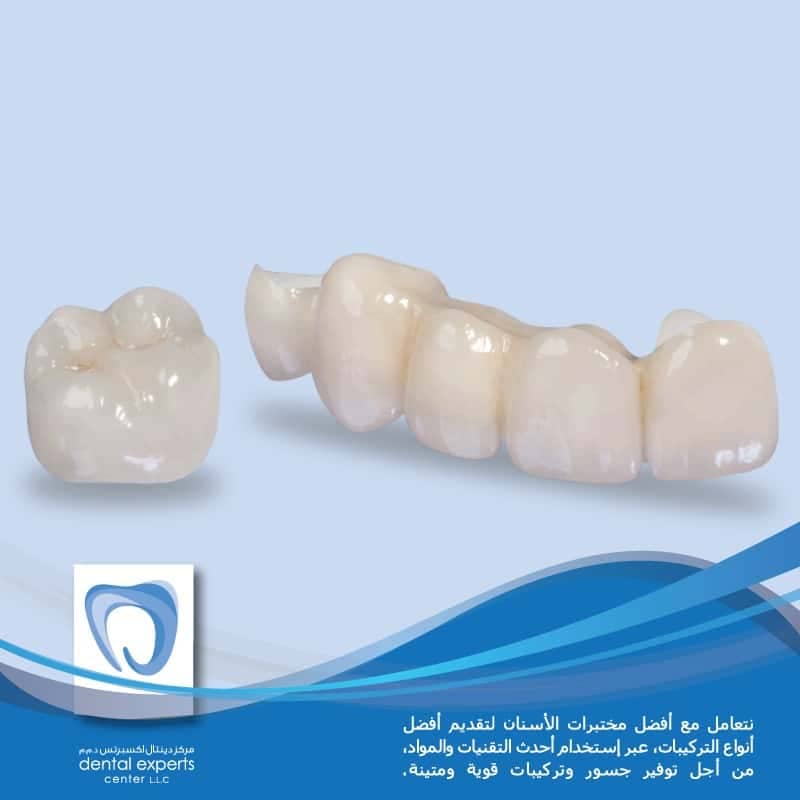 Crowns Dental Bridges 1
