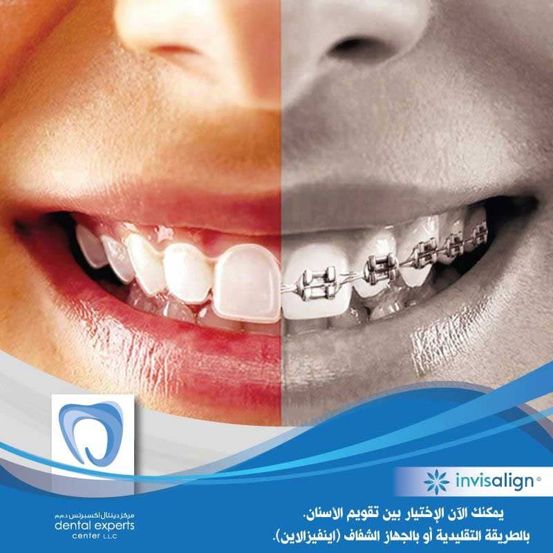 Orthodontic 2